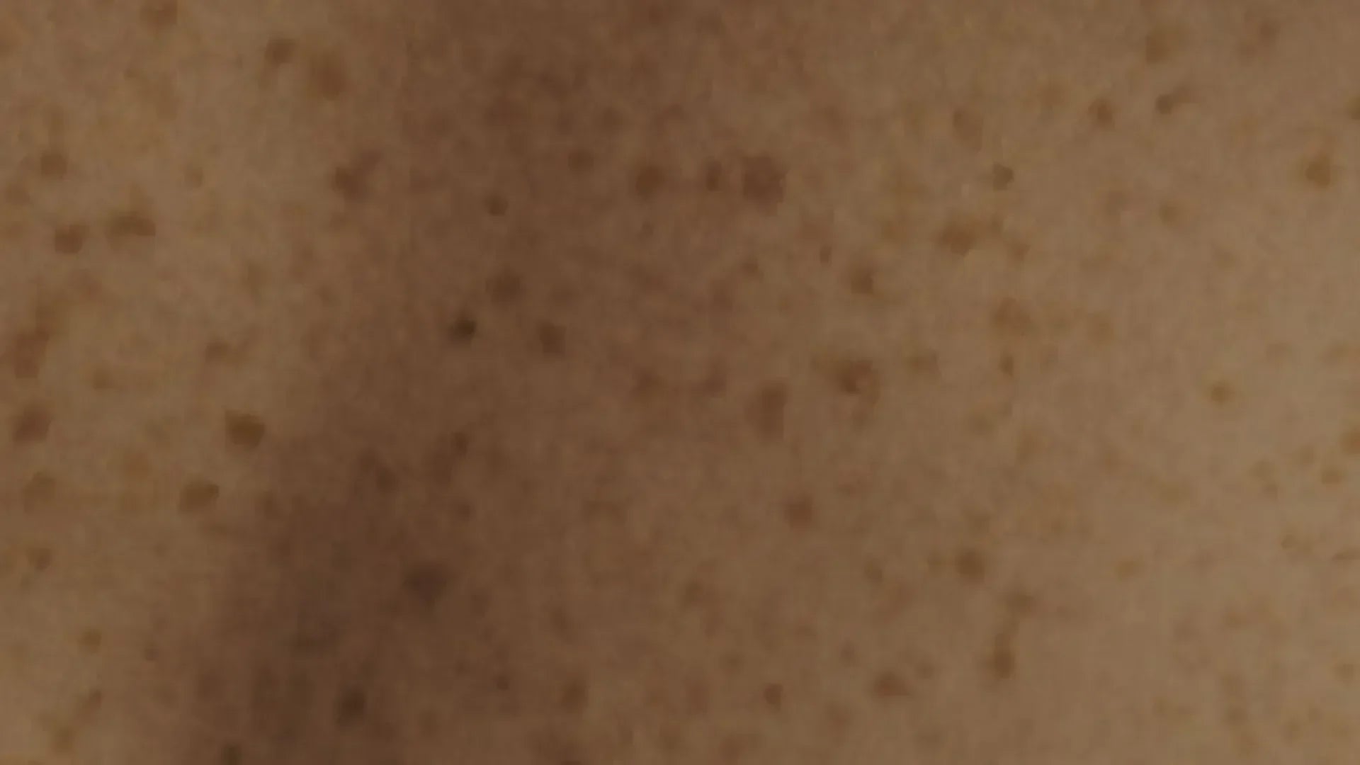 Närbild på kind med fräknar – naturlig hudstruktur för Hall & Hatjes bakgrund