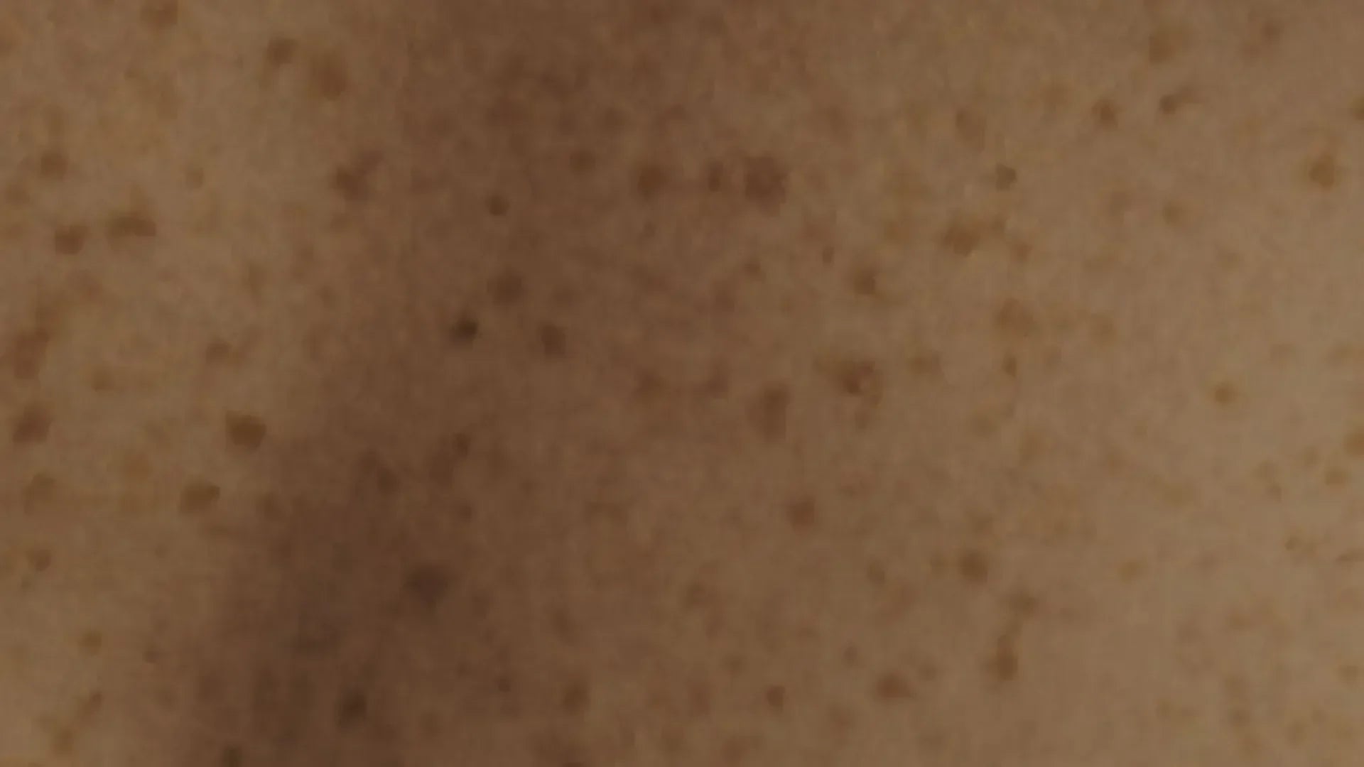 Närbild på kind med fräknar – naturlig hudstruktur för Hall & Hatjes bakgrund